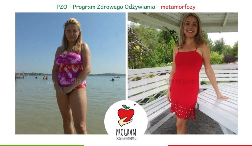 Metamorfoza w Programie PZO Barbra Brodziak Luszcz