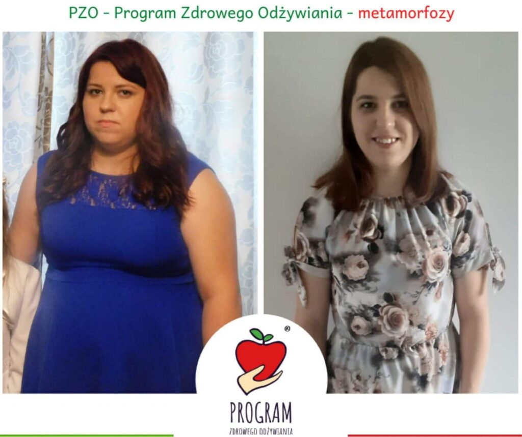 Metamorfoza w Programie PZO - Kasia Matysiak